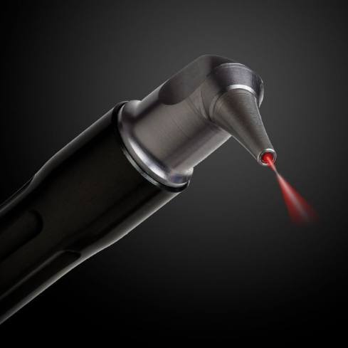 LightScalpel laser frenectomy treatment tool