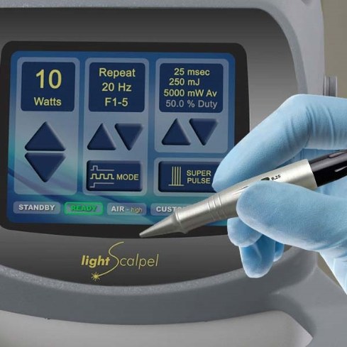 LightScalpel laser frenectomy system