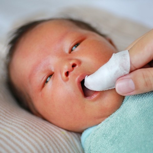 Dentist examining infant with lip tie