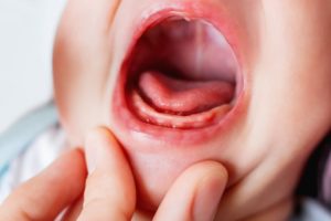 closeup of a baby’s tongue