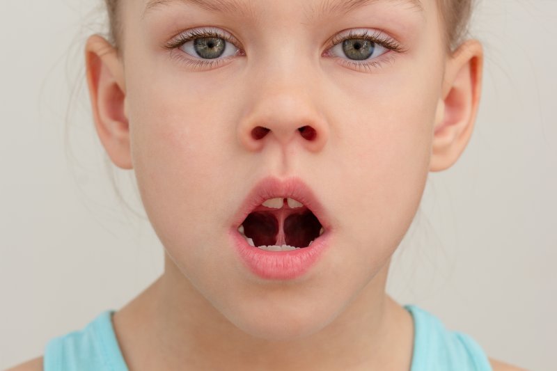 child with a tongue-tie